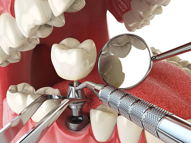 Best Emergency Broken Tooth Repair in Mathews, VA